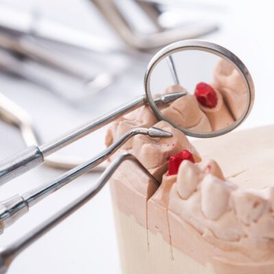 Periodontologia: Ochrona Twoich dziąseł przed chorobami