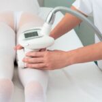 Skuteczne sposoby przygotowania do zabiegu endermologii: praktyczne wskazówki