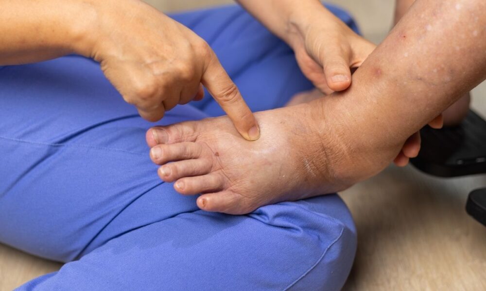 How Does Diabetes Impact Foot Health?