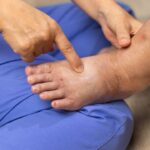 How Does Diabetes Impact Foot Health?