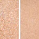 Skóra odwodniona vs sucha – jak rozpoznać i jak poprawić nawilżenie